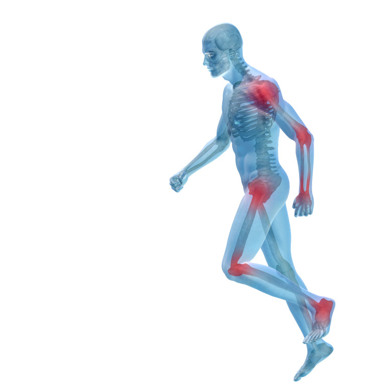 Cartilagine ingegnerizzata in vitro per l’osteoartrite