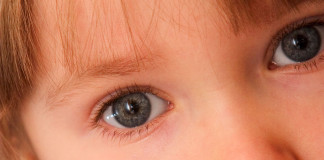 Cheratocongiuntivite vernal VKC