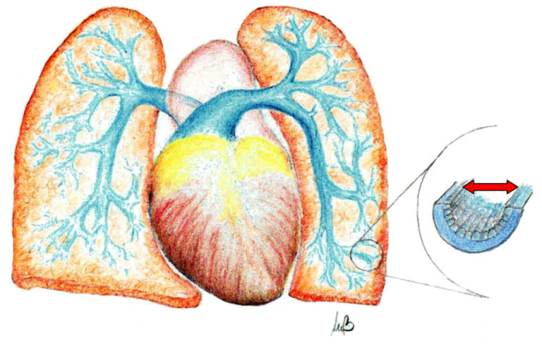 Riociguat per ipertensione polmonare