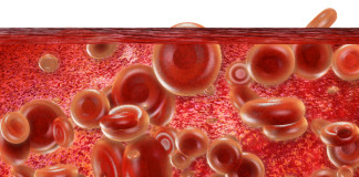 rFIXFc per l’emofilia B. Parere favorevole del CHMP