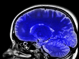Tossicità dei mezzi di contrasto al gadolinio