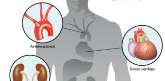 Empagliflozin riduce il rischio di nefropatia nel diabete di tipo 2