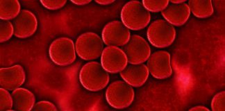 Malattie del sangue: i costi per l’economia europea