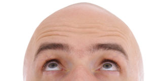 Alopecia, terapia con i fattori di crescita da staminali del tessuto adiposo