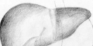 Grazoprevir/elbasvir approvata in Europa per l’epatite C