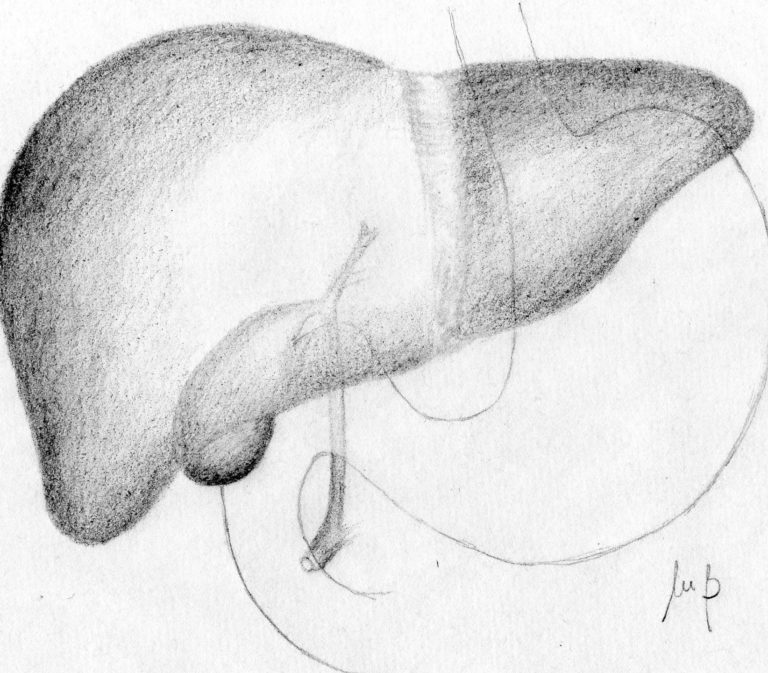 Grazoprevir/elbasvir approvata in Europa per l’epatite C