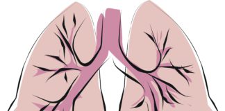 Indacaterolo/glicopirronio bromuro vs salmeterolo/fluticasone per la BPCO