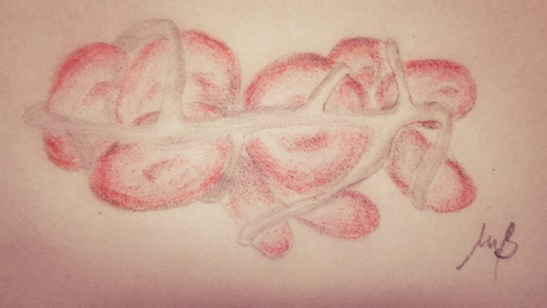 Bay 81-8973 per l’emofilia A