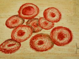 rFVIIIFc (efmoroctocog alfa) per l’emofilia A disponibile in Italia