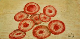 rFVIIIFc (efmoroctocog alfa) per l’emofilia A disponibile in Italia