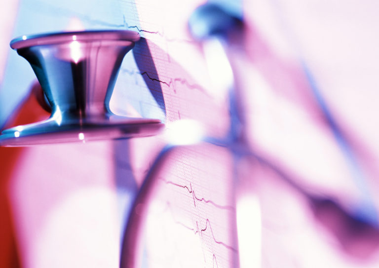 Ventricular Assist Device