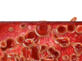 Edoxaban efficace e sicuro anche a dosaggio ridotto per pazienti fragili