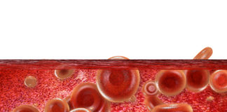 Edoxaban efficace e sicuro anche a dosaggio ridotto per pazienti fragili