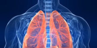 Risultati a lungo termine su nintedanib per la fibrosi polmonare idiopatica