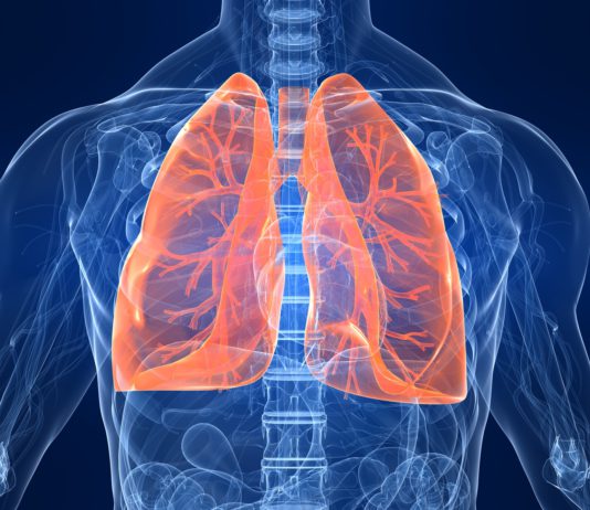 Risultati a lungo termine su nintedanib per la fibrosi polmonare idiopatica