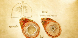 Asma