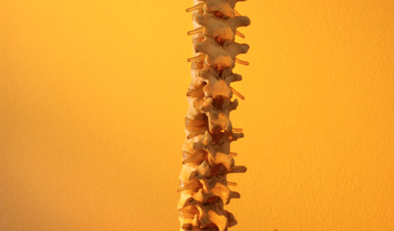 Sistema di ablazione a radiofrequenza OsteoCool per i tumori ossei