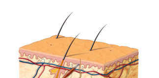 Medicazione solida idrosolubile per le ulcere cutanee