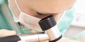 Cobimetinib/vemurafenib per il melanoma approvato in Italia