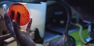 Ceftolozano/tazobactam per infezioni da batteri multiresistenti