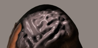 Emicrania