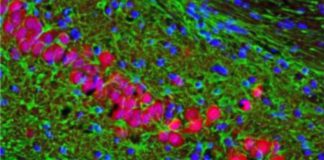 Un nuovo target molecolare per l’Alzheimer