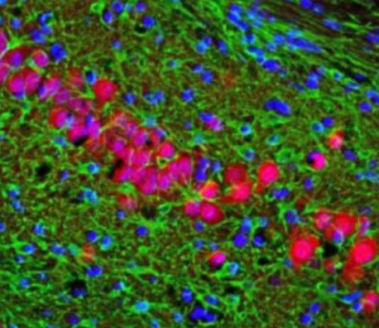 Un nuovo target molecolare per l’Alzheimer
