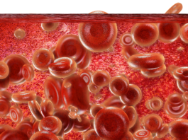 Emicizumab per l’emofilia A