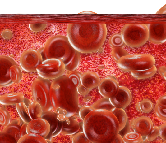 Emicizumab per l’emofilia A