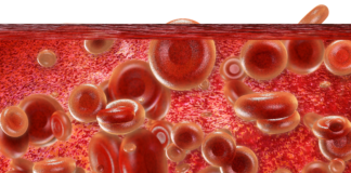 Dabigatran per la FANV favorisce l’aderenza alla terapia