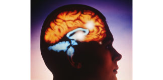 Dispositivo indossabile per persone con epilessia o disabilità motorie