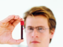 Biosimilare di rituximab per alcuni tumori ematologici
