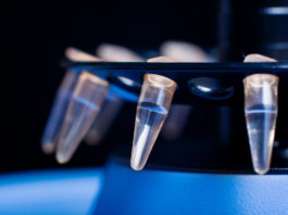 Ebola: identificati marker di replicazione del virus nel polmone di un paziente