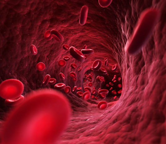Edoxaban efficace e sicuro anche per i pazienti con TEV a più alto rischio