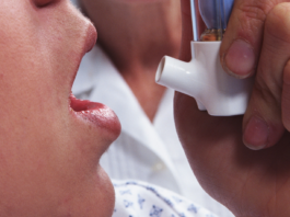 Omalizumab per l’asma allergico grave (AAG)