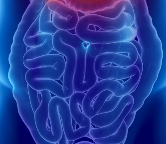 Biosimilare infliximab per le malattie infiammatorie croniche intestinali