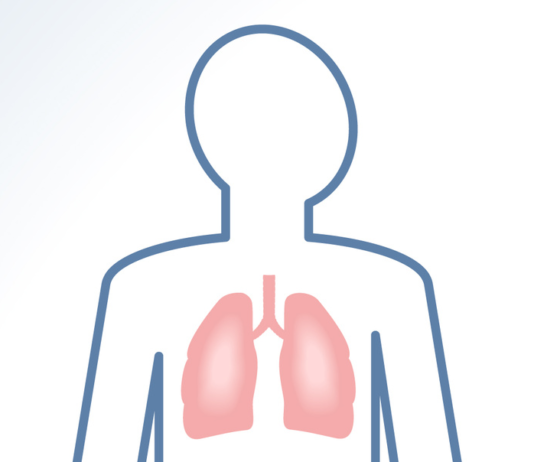 Pembrolizumab per NSCLC in prima linea approvato in UE