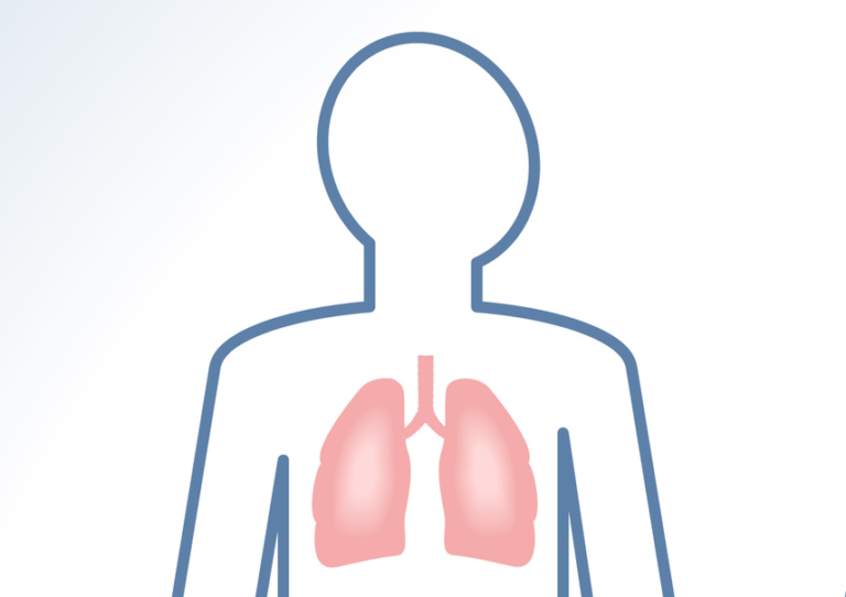 Pembrolizumab per NSCLC in prima linea approvato in UE