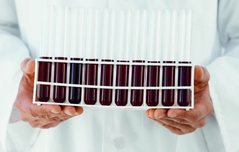 Bay 81-8973 (octocog alfa) per l’emofilia A rimborsabile in Italia