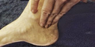 Diagnosi e terapie dell’arteriopatia obliterante periferica per prevenire le amputazioni