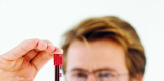 Inotuzumab ozogamicin per la leucemia linfoblastica acuta refrattaria o recidivante