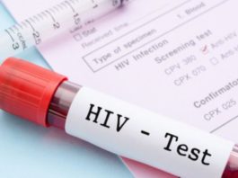 Gene editing per curare l’Hiv nei topi