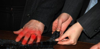 Baricitinib per il dolore nell’artrite reumatoide