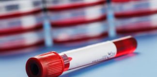 Lenalidomide come terapia di mantenimento nel mieloma multiplo dopo trapianto Una meta-analisi mostra un beneficio significativo in termini di sopravvivenza globale con la terapia di mantenimento con lenalidomide nei pazienti con mieloma multiplo di nuova diagnosi dopo trapianto autologo di cellule staminali