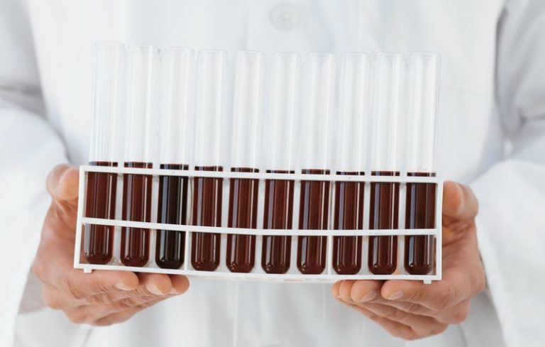 Rivaroxaban per la FA in pazienti sottoposti a intervento coronarico percutaneo con inserimento di stent