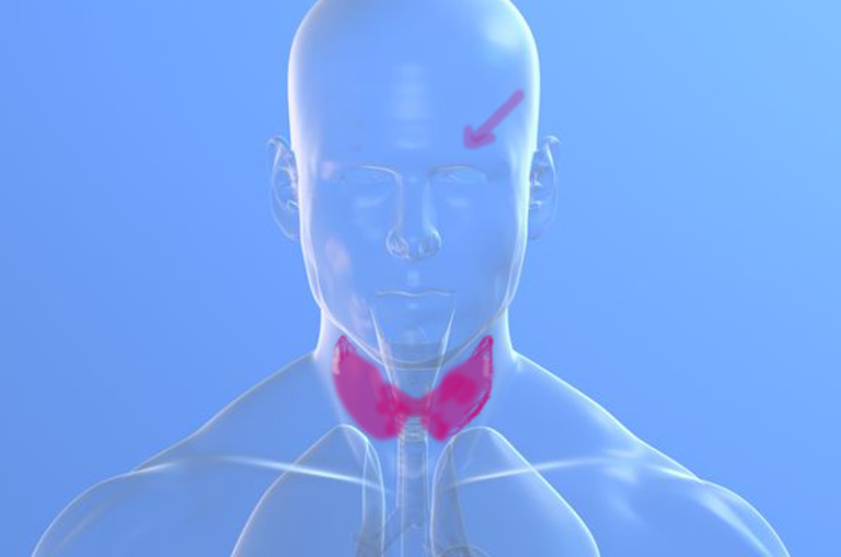 Il morbo di Basedow-Graves