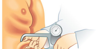 Le sindromi lipodistrofiche