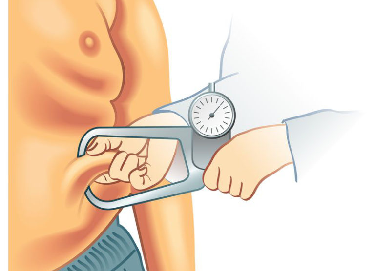 Le sindromi lipodistrofiche