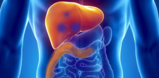 Microsfere con ittrio-90 per metastasi al fegato da tumore primario al lato destro del colon