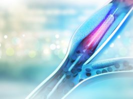Stent con rivestimento in titanio-ossido nitrico